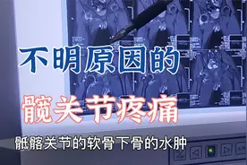 小男孩髋关节出现不明原因的疼痛是怎么回事？肖教授阅片讲解原因视频封面