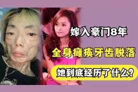 嫩模嫁入豪门8年，瘦到44斤全身瘫痪牙齿脱落，她经历了什么？视频封面