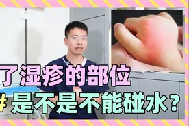长了湿疹的部位，是不是不能碰水？视频封面