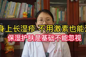 身上起湿疹不用激素也能治，皮肤科张医生教你三步赶走湿疹不是梦视频封面