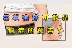 带状疱疹：让人疼痛难忍，还可能是癌症预警！这几类人要特别警惕视频封面