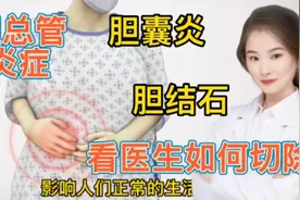 医学演绎 胆结石 胆囊炎 胆管炎症 医生如何进行手术摘取视频封面