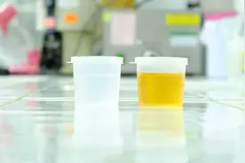 糖尿病尿酮阳性是怎么回事？能转阴吗？医生告诉你