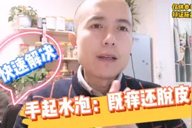 汗疱疹！手上起水泡，痒还脱皮？用这个方法快速止痒，简单有效！视频封面