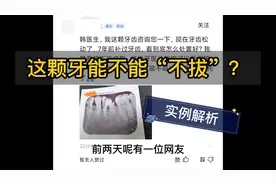 当地医生让拔了再镶！这颗牙能“不拔”吗？——网友问题解答视频封面