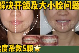 南京牙齿矫正|左右脸不对称怎么解决？视频封面