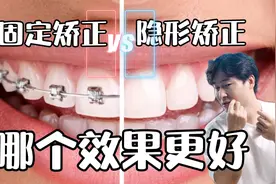 隐形牙套VS钢牙，哪种矫正效果更好？应该怎么选？视频封面
