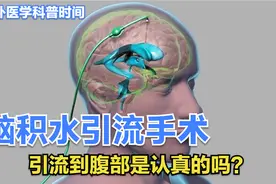 解决脑积水的两种引流方法，把积水引流到腹部是认真的吗？视频封面