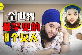 浑身长满毛发，剪掉之后是大美女？盘点世界上最罕见的8个女人视频封面
