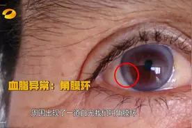 面相显老，心脏也老？提示心脏健康的信号你注意了吗|新闻大求真