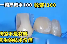 牙科医生补牙的技术值钱，补一颗牙1000，补一颗成本就回来了视频封面