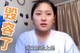 玲儿脸上突然长出很多红点点，还一直失眠，不知道该怎么办了？视频封面