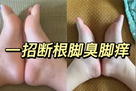 脚臭脚痒一招断根啦！好了没再反复过！学到了！视频封面