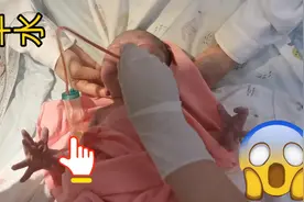 刚出生的宝宝肚子里还有羊水，医生急得疯狂拍打，想不到会这样视频封面