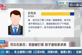 孩子参加夏令营却惨遭殴打，孩子双腿被打紫，递纸条求救视频封面