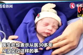 女子刚诞下男婴，不到一个月又产下龙凤胎,医生:从没见过这样的事视频封面