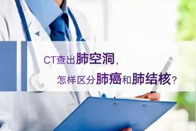 肺癌空洞和肺结核空洞，CT片怎么区分？医生教您看CT视频封面
