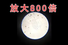 把“尿液”放大800倍，原来尿骚味看起来是这样的！