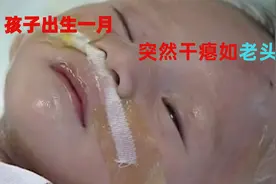 才出生1个月的孩子，突然干瘪如老头，公公却说要放弃孩子@视频封面