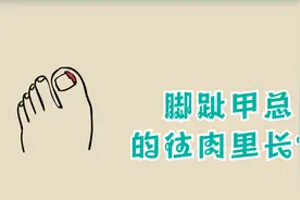 脚趾甲总烦人的往肉里长应该怎么办？视频封面