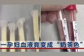 吓人！一孕妇每天一杯奶茶，血液竟变成奶茶色