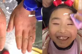 贵州一小学孩子手脸皲裂，老师自购宝宝霜，学生排队涂抹一脸幸福视频封面