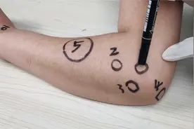 王学昌教授：肘关节疼痛常见7种疾病视频封面