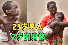 23岁的成年人，拥有2岁的身体，他的生活到底发生了什么？视频封面
