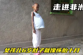 这个女孩6岁肚子就像怀胎十月一样大视频封面