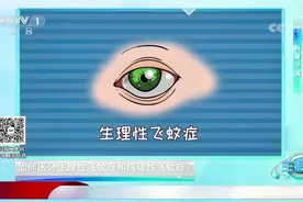如何区分病理性飞蚊症和生理性飞蚊症？专家有妙招，来看|生活圈视频封面