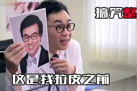 大鹏整容前后对比，石榴姐感叹，你以前长的真丑！爆笑整容视频封面