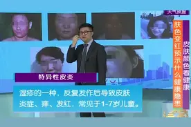 专家详细解释，发现皮肤变红，有哪些健康隐患视频封面