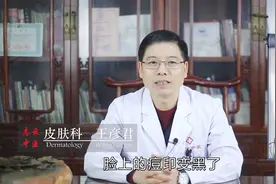 脸上痘痘留下的黑色痘印，特别不容易下去，我们可以这样去处理！视频封面