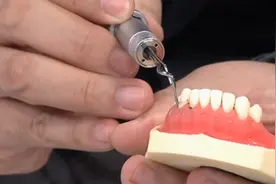 看清洗牙、龈下刮治全过程，定期洗牙，对于保护口腔健康很有必要视频封面