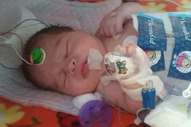 宝宝也会怀孕？男婴出生四天后被医生“剖腹”告知：寄生胎