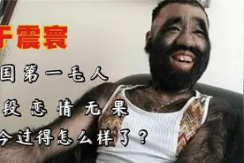 中国第一毛人于震寰42岁被逼脱毛娶娇妻如今过得怎么样了？视频封面
