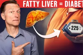 你的脂肪肝导致了你的糖尿病，柏格医生视频封面