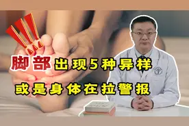 疾病到来，“脚部”先知？脚部出现5种异样，或是身体“拉警报”