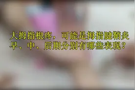 大拇指根疼，可能是拇指腱鞘炎，早、中、后期分别有哪些表现？视频封面