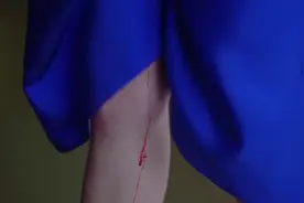 翻译官：嘉怡意外摔跤小产，呼叫闺蜜带人求助，结果带来脑科医生