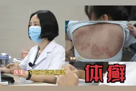女子背部大面积体癣反复发作  瘙痒难忍  罪魁祸首是真菌视频封面