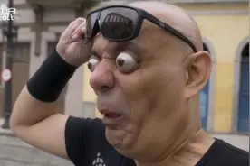 吓人！ 巴西男子眼球“爆凸1.8公分”创吉尼斯世界纪录