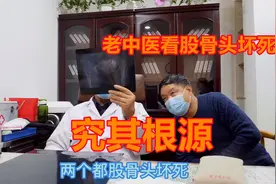 28岁女子吃激素，竟吃成了股骨头坏死，医生：用药需谨慎！视频封面