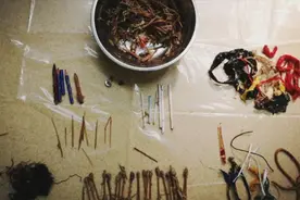 不可思议！30根牙签、24根棉签、5根铅笔段，从9岁男孩胃里取出！视频封面