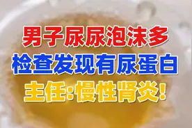男子尿尿泡沫多，检查发现尿蛋白，主任：慢性肾炎！视频封面