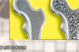 钙片空腹服用，是不是效果更好？听听专业人士怎么说！视频封面