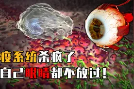 人的身体不承认眼睛的存在？免疫系统杀疯了，连眼睛都不放过？视频封面