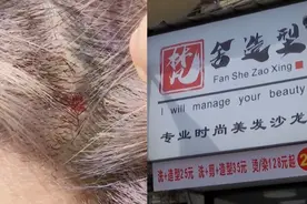 女孩染发后头皮溃烂，维权时商家气焰嚣张：我们是黑户，你去报视频封面