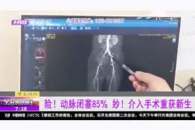 腿脚不灵便的人注意了，可能是得了动脉硬化闭塞，严重的需要手术