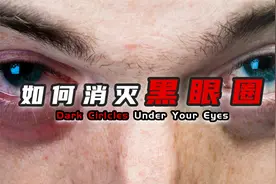 不想被贴“渣”的标签？教你识别黑眼圈类型，三步重获清白人生视频封面